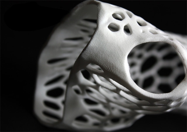 Новое в медицине - экзоскелетный гипс (3D-печать) дизайн, медицина, технологии