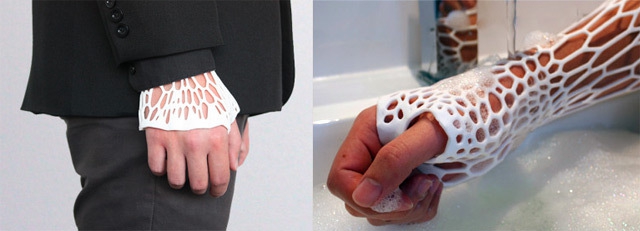 Новое в медицине - экзоскелетный гипс (3D-печать) дизайн, медицина, технологии